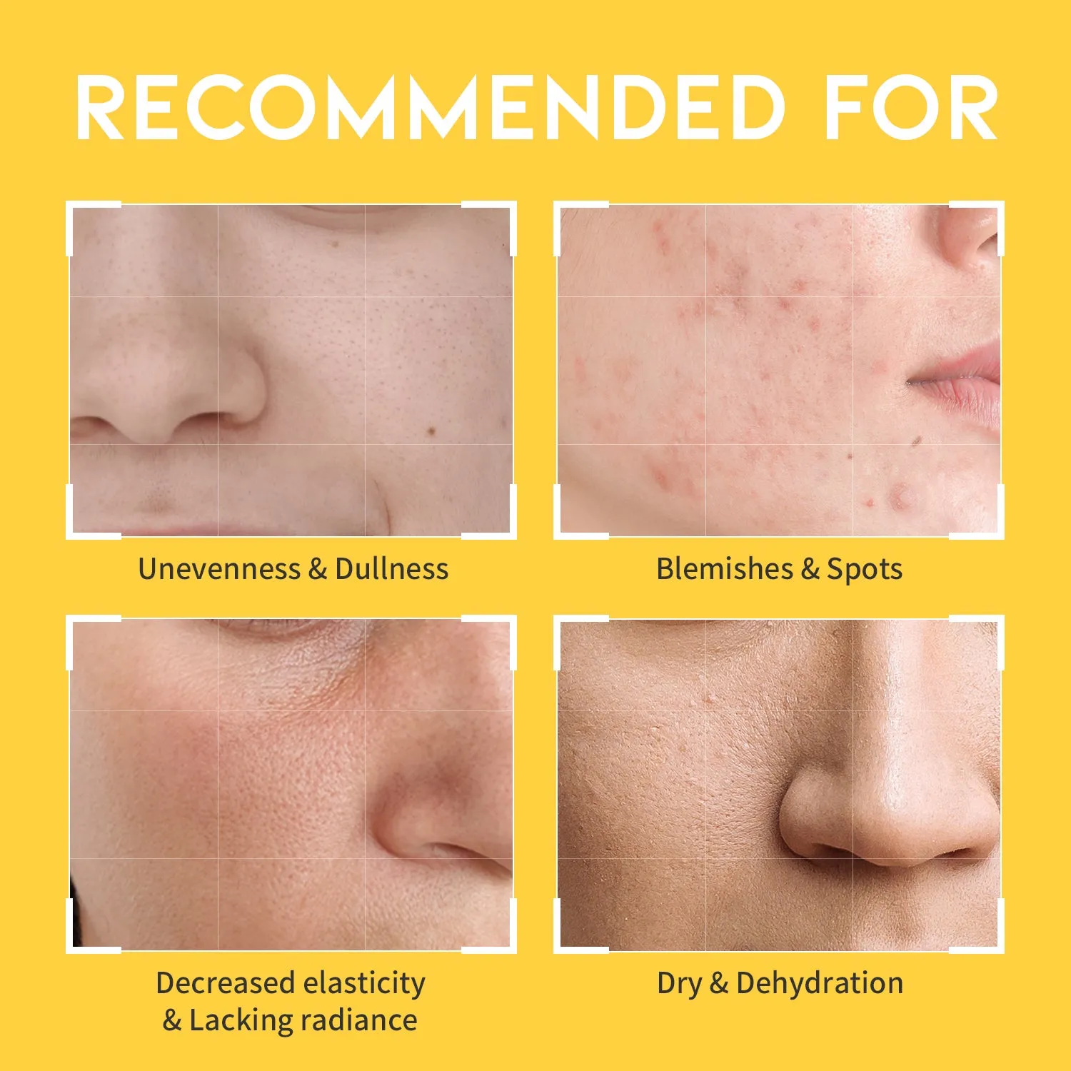 Dark Spot Vitamin C Toner