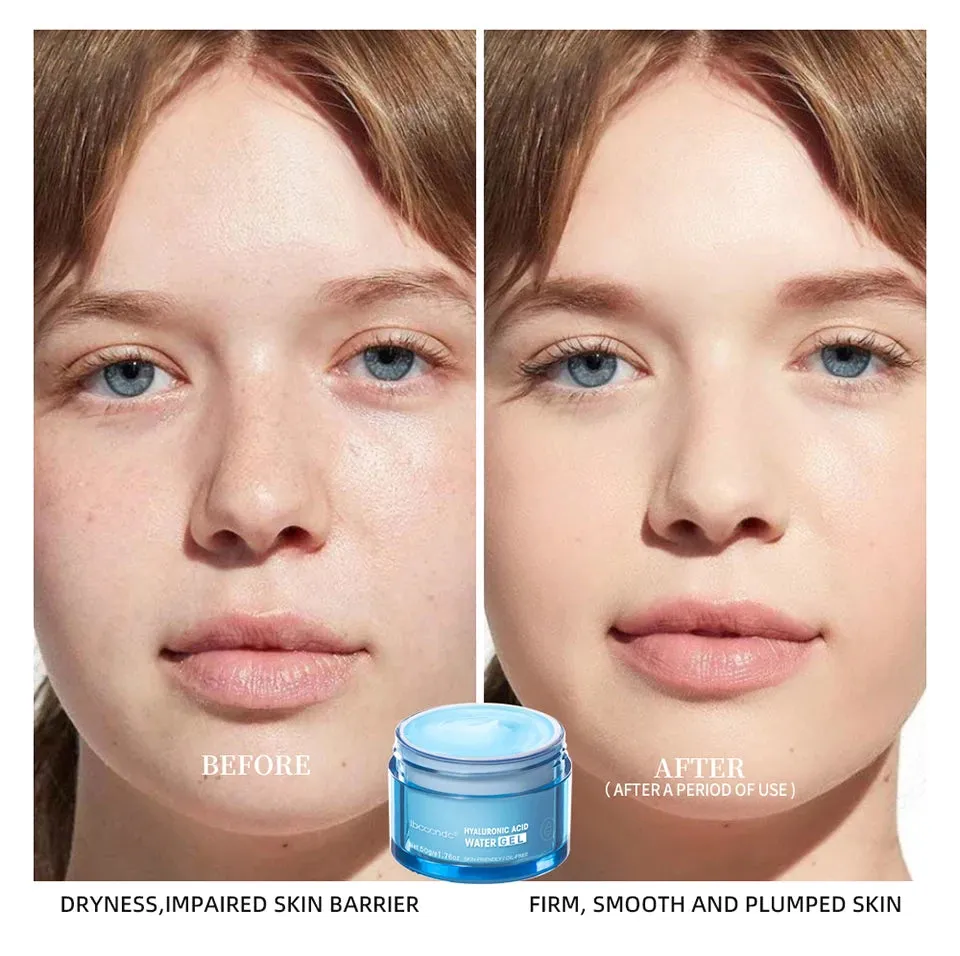 Hydro Boost Face Moisturizer with Hyaluronic Acid for Dry Skin Oil-Free and Non-Comedogenic Water Gel Face Lotion